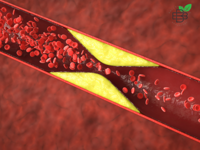 diet for high cholestrol control in kalyan